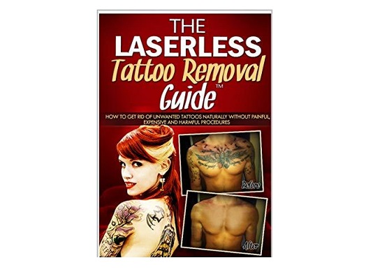 Laserless Tattoo Removal